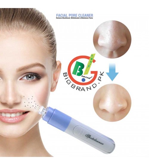 Facial Blackhead and Spot Cleaner